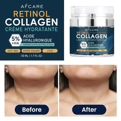 Duo Collagène & Rétinol – Soin Hydratant & Anti-Âge & Anti-rides