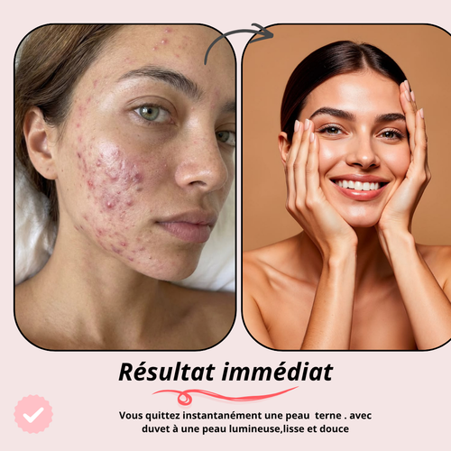 Rouleau à glace pour le visage – Ici Roller